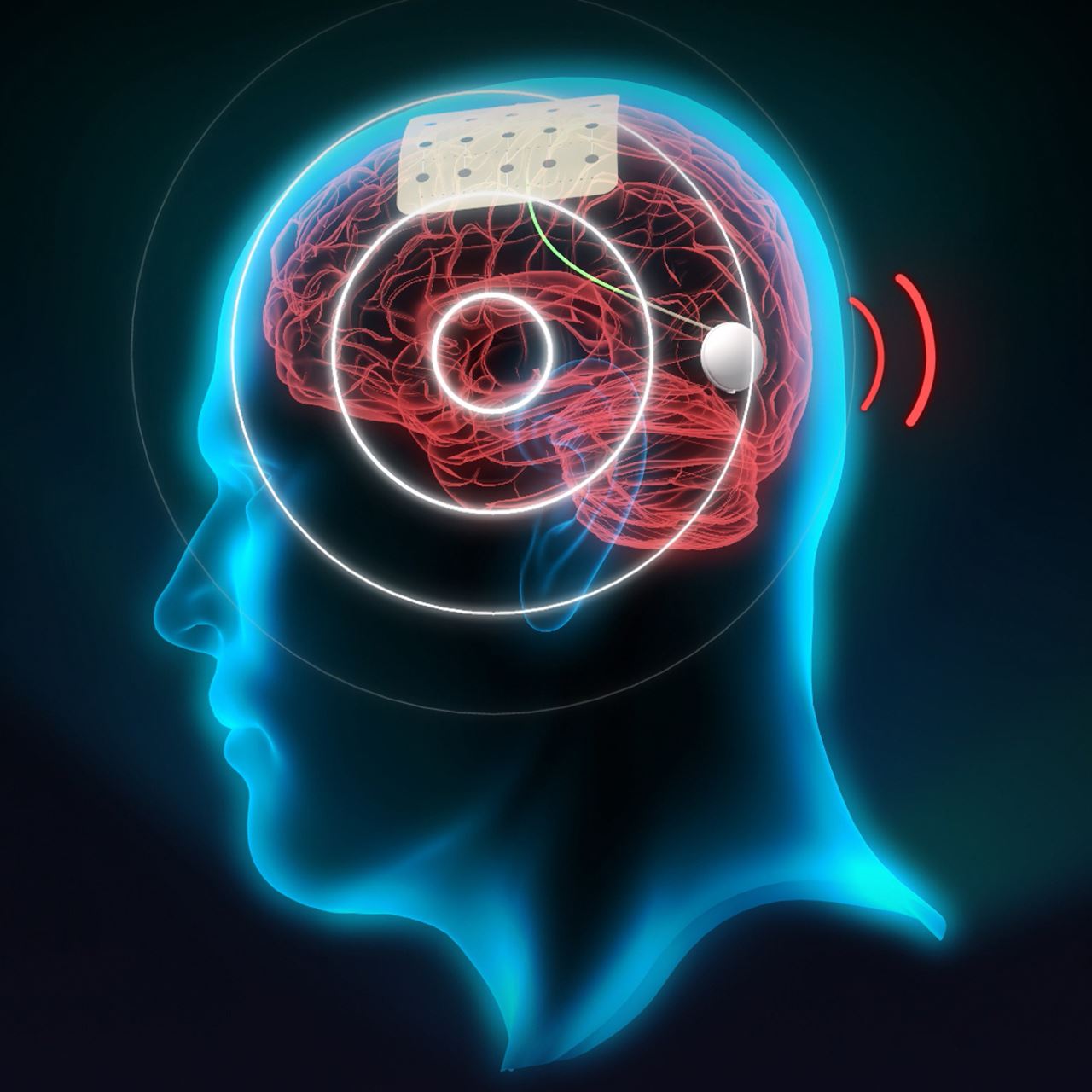 Illustration of ICN2 Brain Sensor