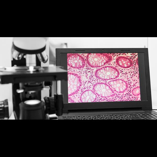 Transforming cancer diagnosis 