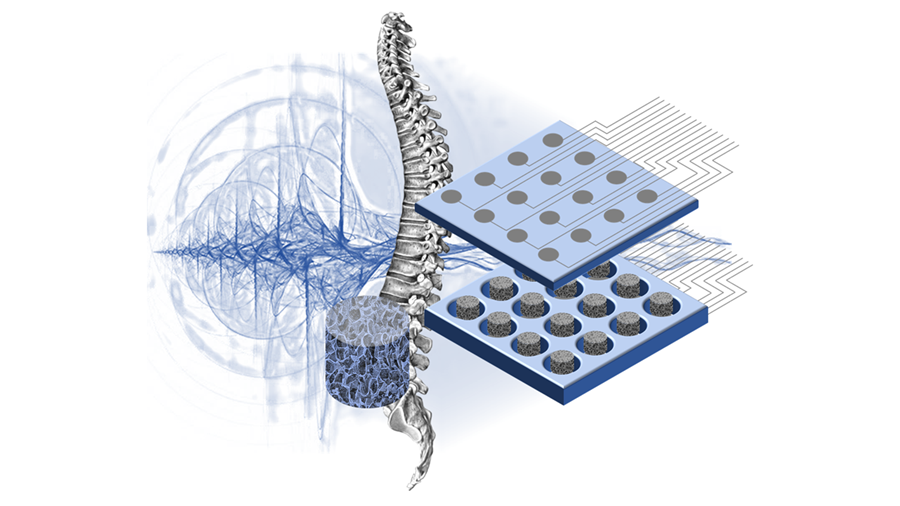 Promoting neural regeneration with graphene-enriched scaffolds
