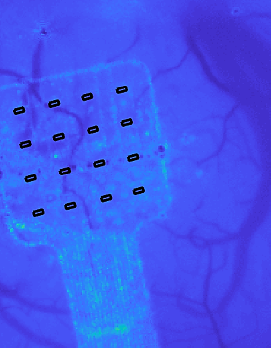 brain sensor